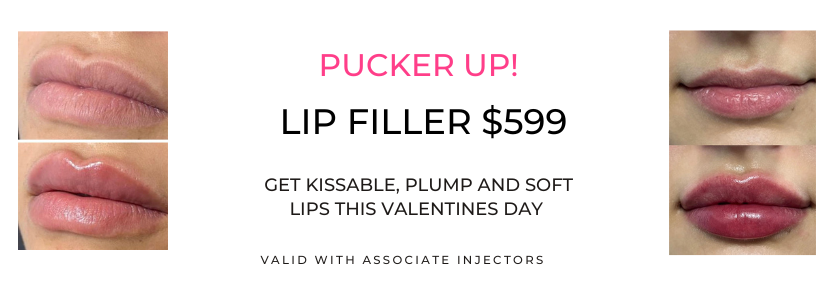 Lip Filler Promo, February Specials at Khrome MedSpa & Wellness